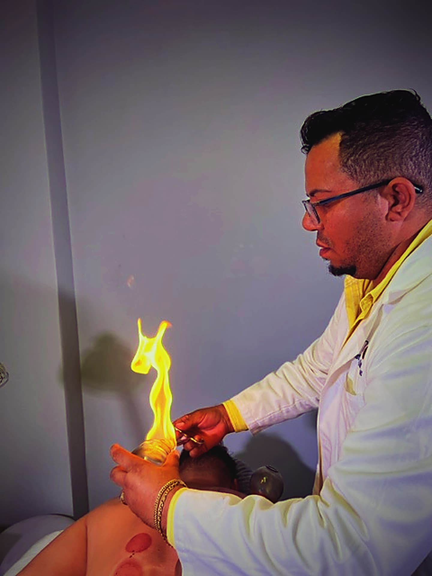 Dr. Adriano Nunes Grieser performing fire cupping at My Long Life Acupuncture